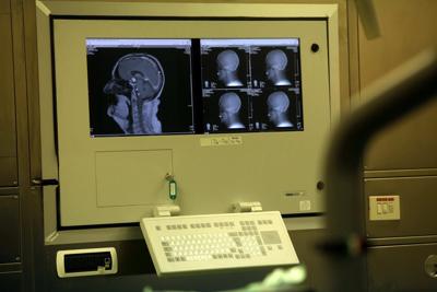 imaging_cervello_AIftg.jpg