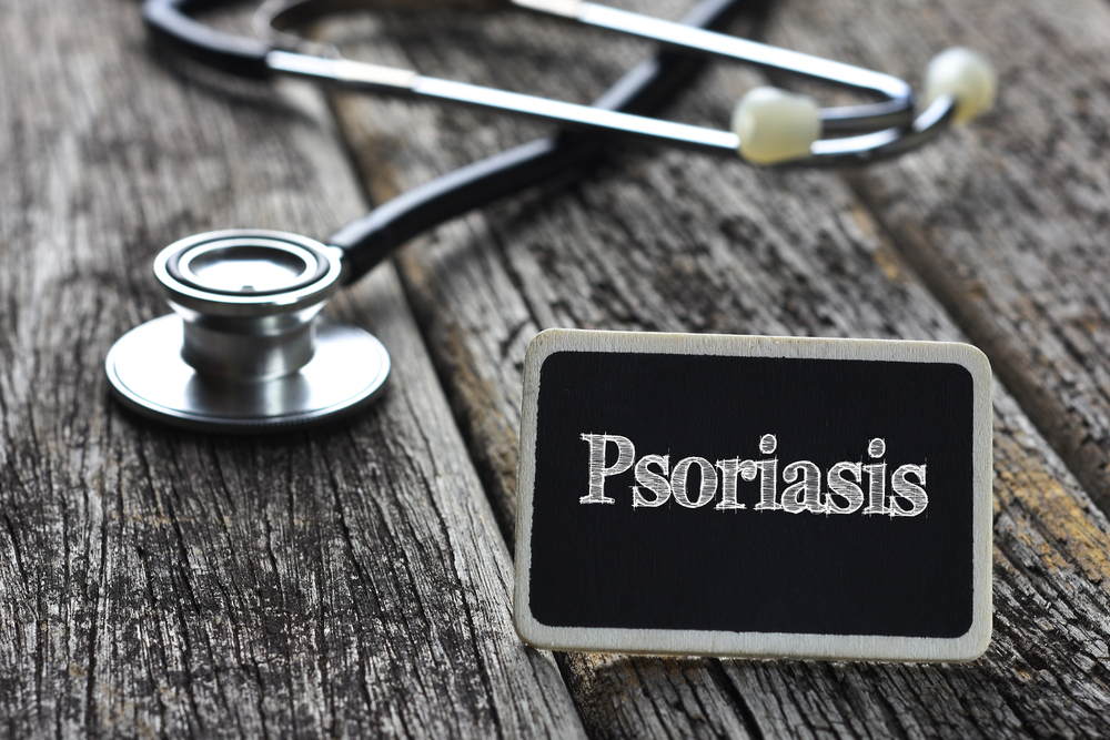 psoriasi