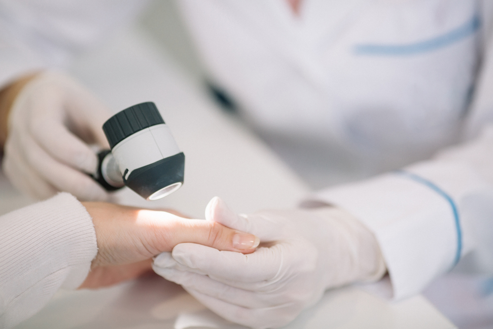 controllo dermatologico