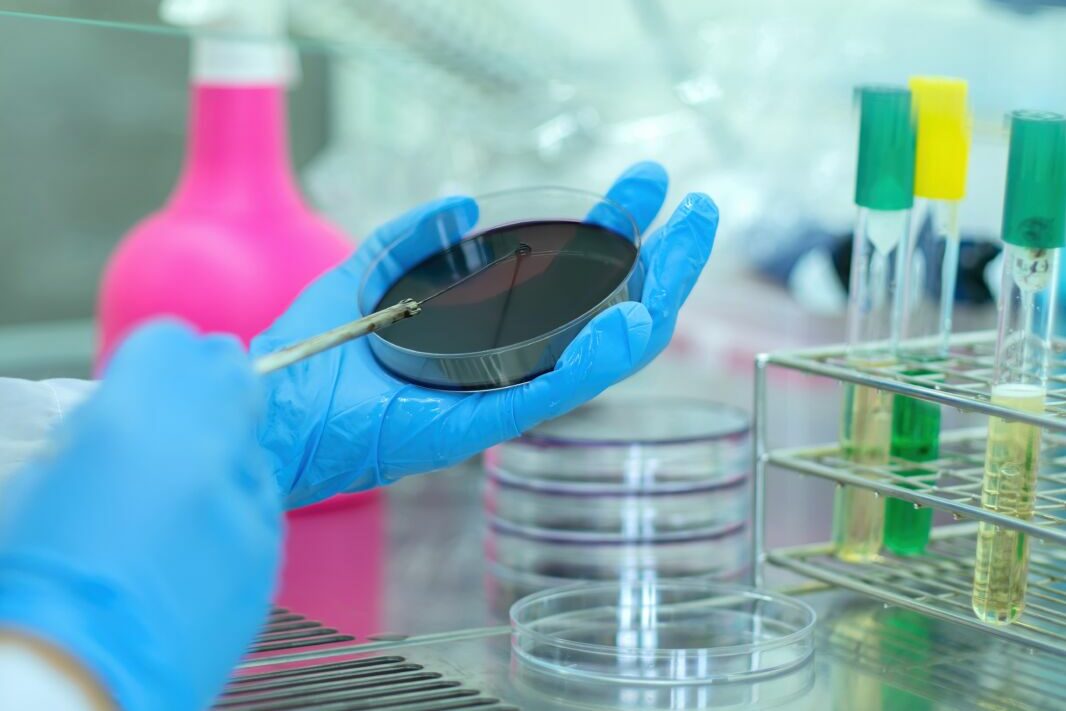 Lavoro su cultura batterica contro l'antibiotico resistenza.