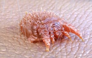 acaro scabbia