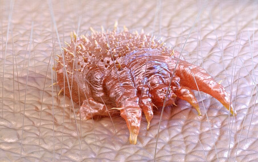 acaro scabbia