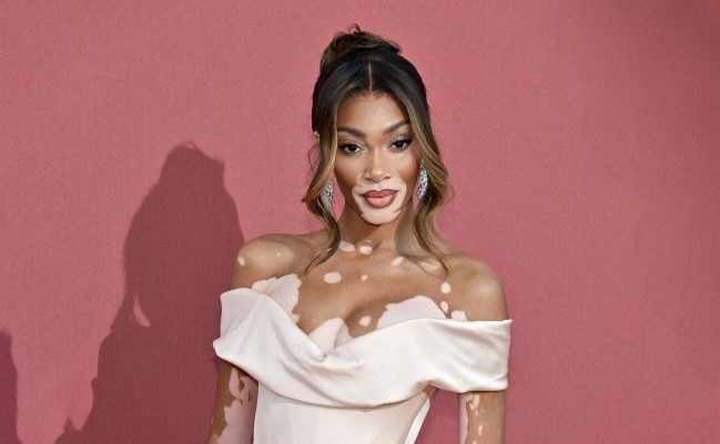 Winnie Harlow, la prima modella con vitiligine a conquistare alcune delle copertine più importanti.