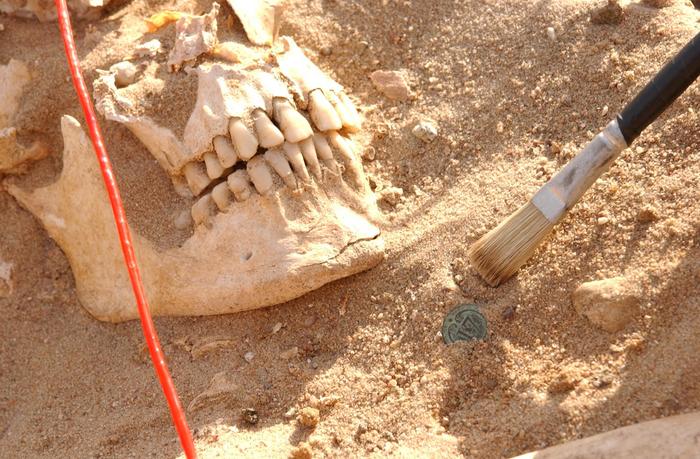 Cranio di un soldato dell'esercito di Napoleone accanto a un bottone dell'uniforme di un soldato/ Credit Michel Signoli, Aix-Marseille Université