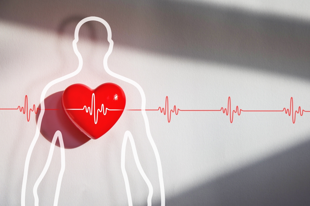 infarto