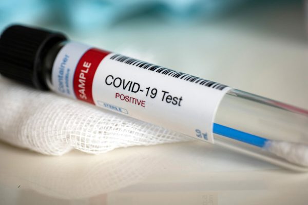 Testing,For,Presence,Of,Coronavirus.,Tube,Containing,A,Swab,Sample