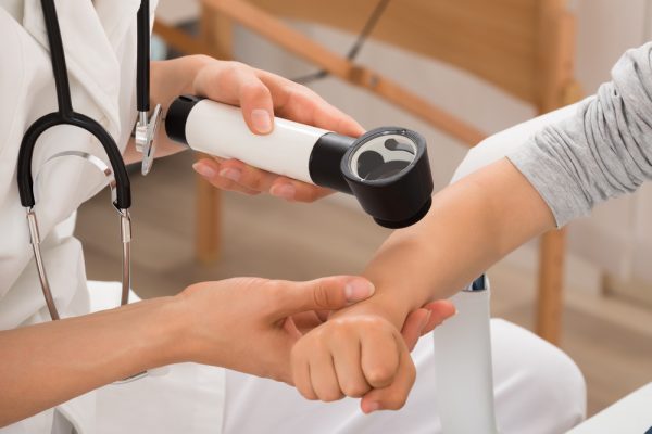 Close-up,Of,Doctor,Examining,Skin,Of,Child,Patient,With,Dermatoscope