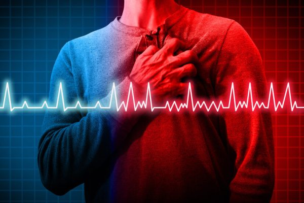 Heart,Disorder,And,Atrial,Fibrillation,Ecg,As,A,Coronary,Cardiac