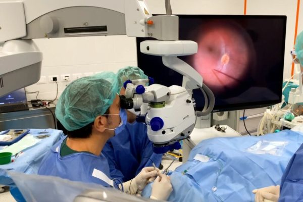 intervento retina