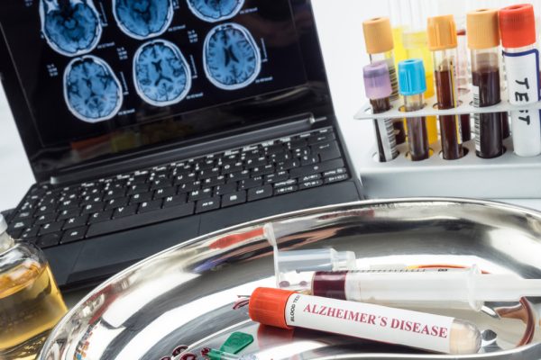 test Alzheimer