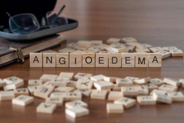 angioedema