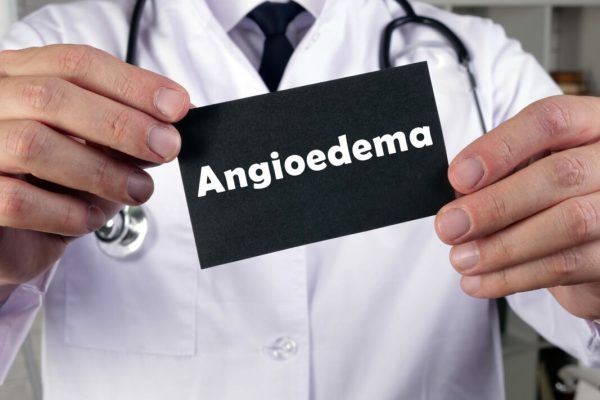 angioedema