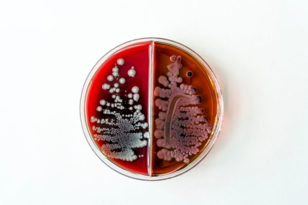 batteri klebsiella