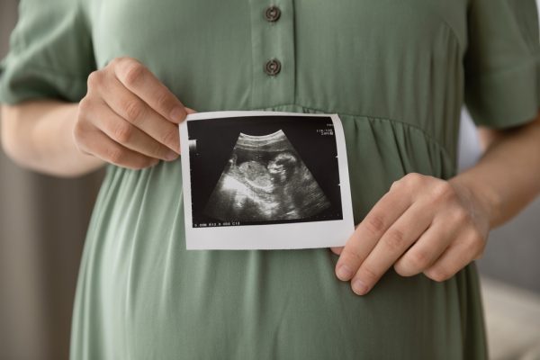 maternità surrogata