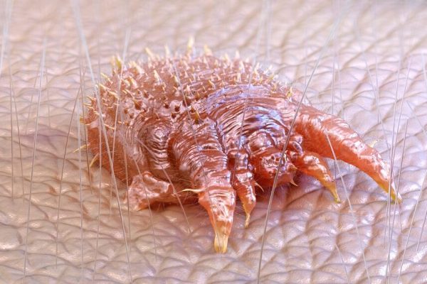 acaro scabbia