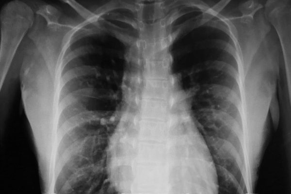 radiografie deepfake