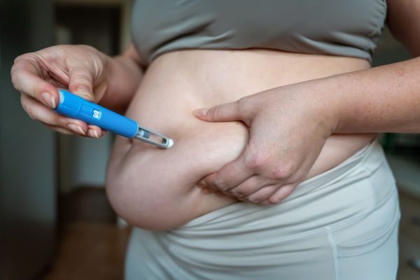 farmaci per l'obesità