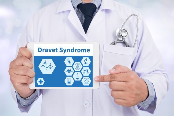 sindrome Dravet