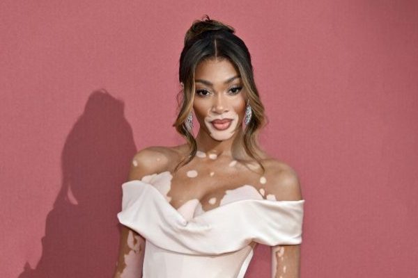Winnie Harlow, la prima modella con vitiligine a conquistare alcune delle copertine più importanti.